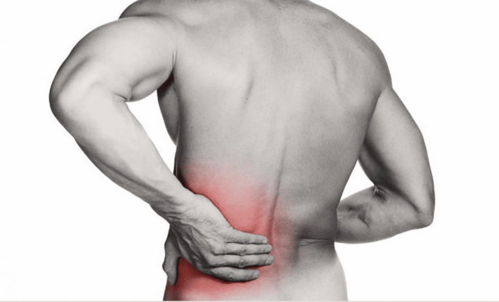 Sciatica Pain - How We Can Help